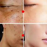 Whitening Freckle Cream