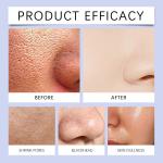 Blue Microneedle Serum and Shrinks pores