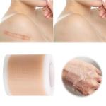 Silicone Gel Scar Patch: Effective treatment for scars