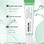 Salicylic Acid Cream - Reduces blackheads