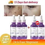 Dark Spot Remover Gummies