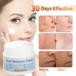 Fast Scar Removal Cream