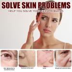 "Rice Anti-Wrinkle Cream