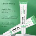 Salicylic Acid Cream - Reduces blackheads