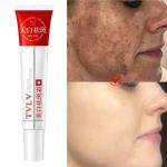 Whitening Freckle Cream