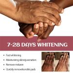 Dark Knuckles Whitening Serum